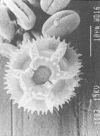 Cvetniprahregratapodmikroskopom